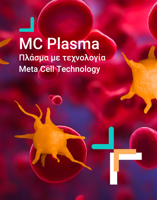 MC Plasma Banner